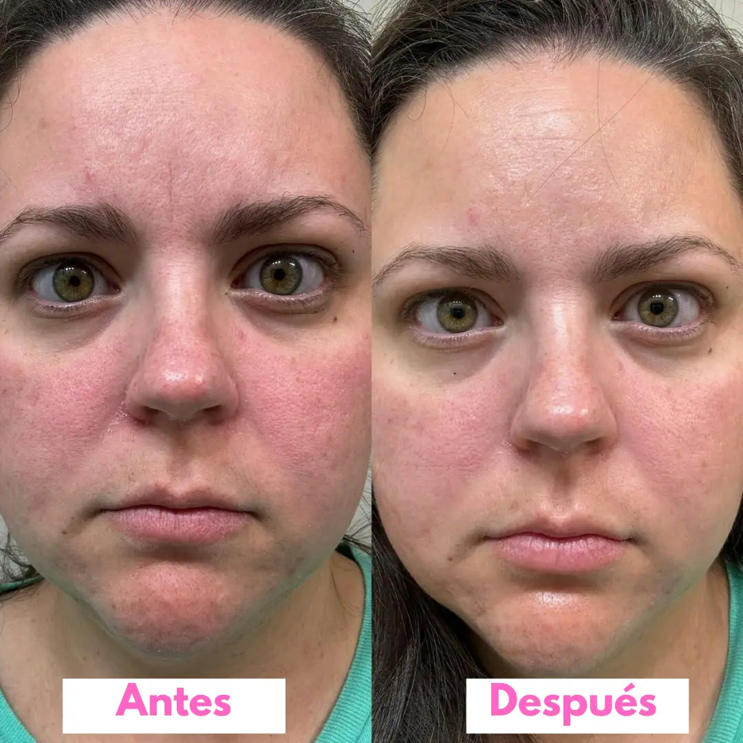 SERONIS — Vuelve a Sentirte Bien con Tu Piel