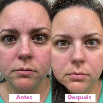 SERONIS — Vuelve a Sentirte Bien con Tu Piel