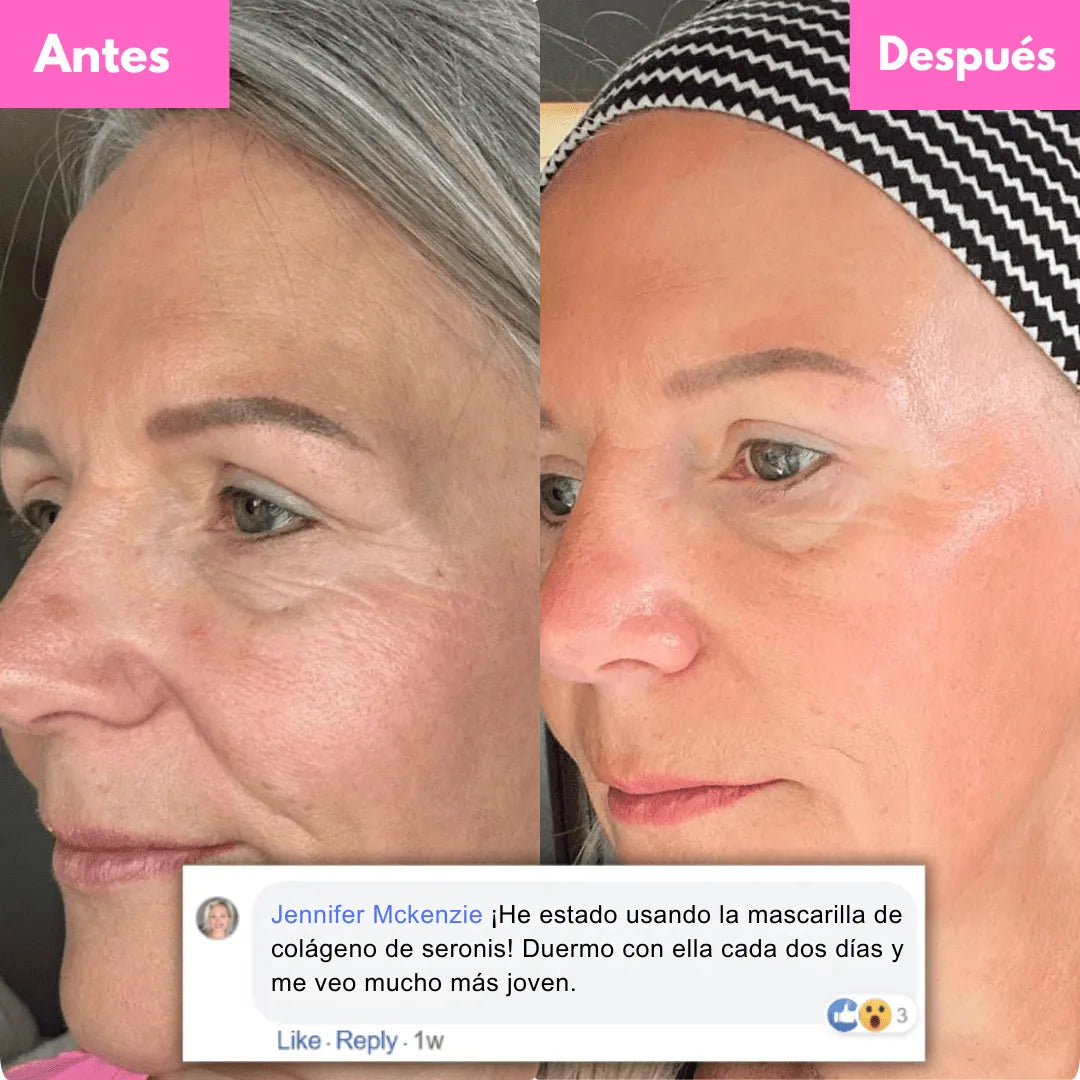 SERONIS — Vuelve a Sentirte Bien con Tu Piel