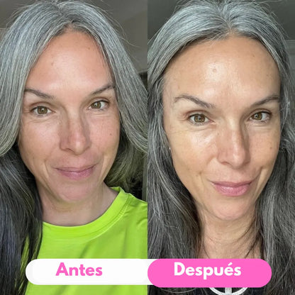 SERONIS — Vuelve a Sentirte Bien con Tu Piel